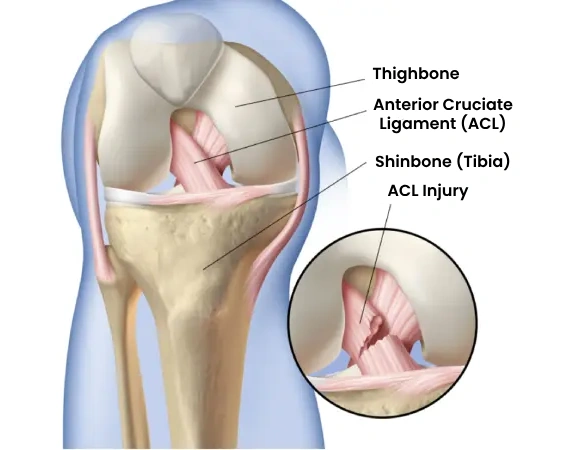 deformed knees results