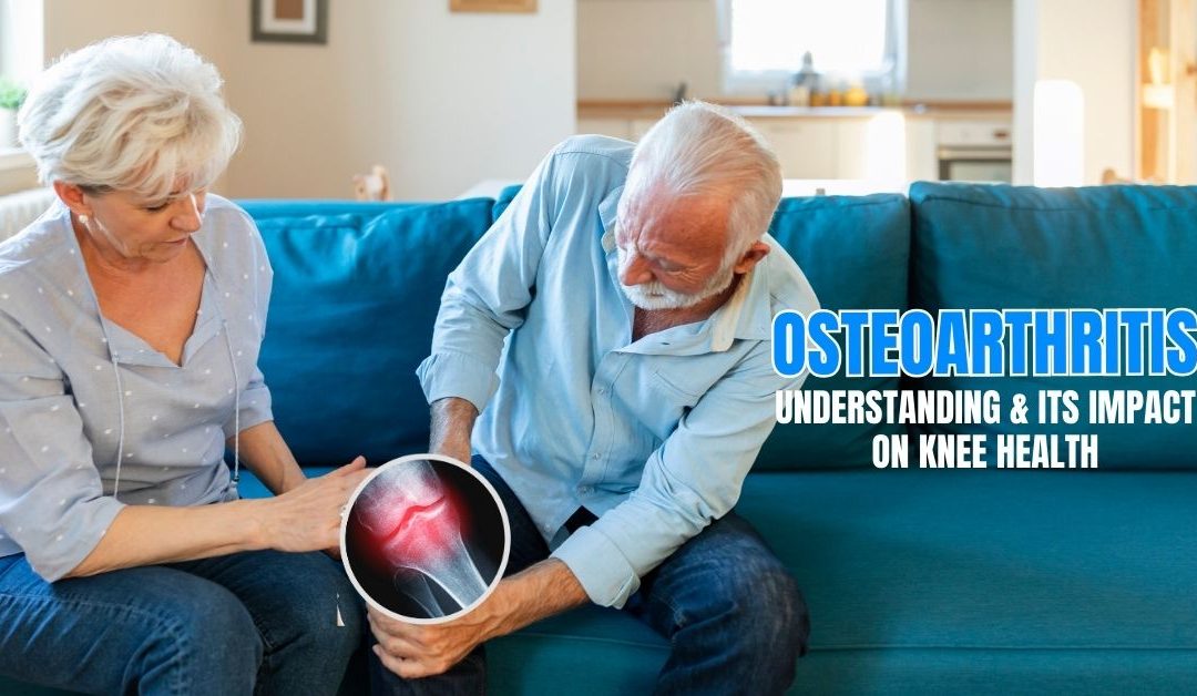 Understanding Osteoarthritis and Its Impact on Knee Health