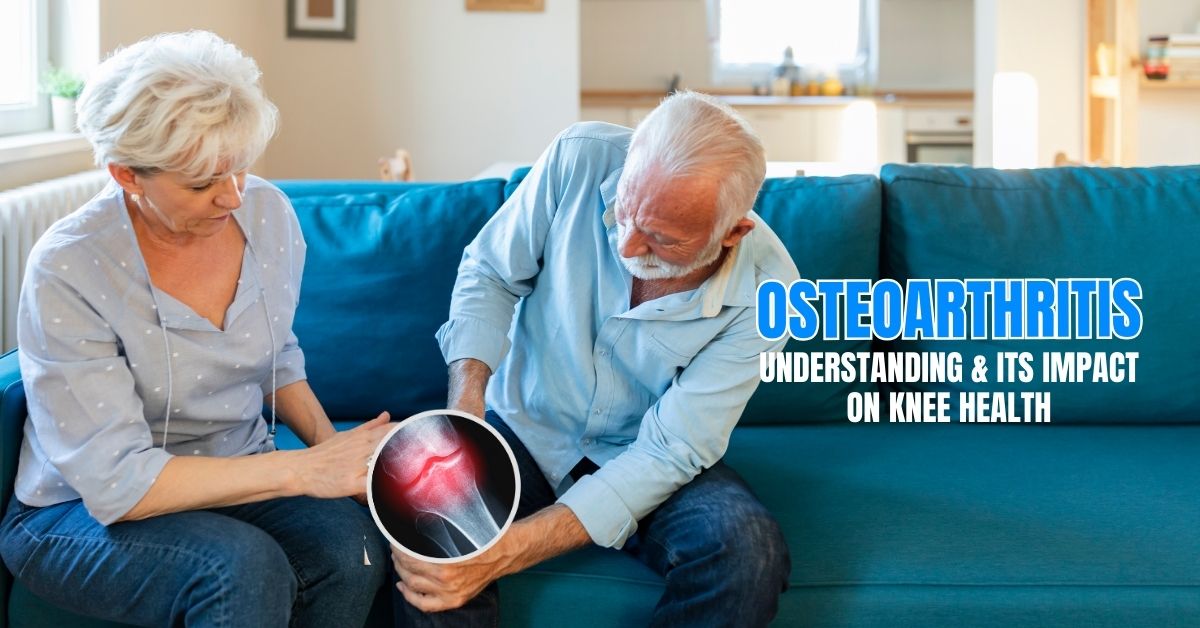 Understanding Osteoarthritis and Its Impact on Knee Health