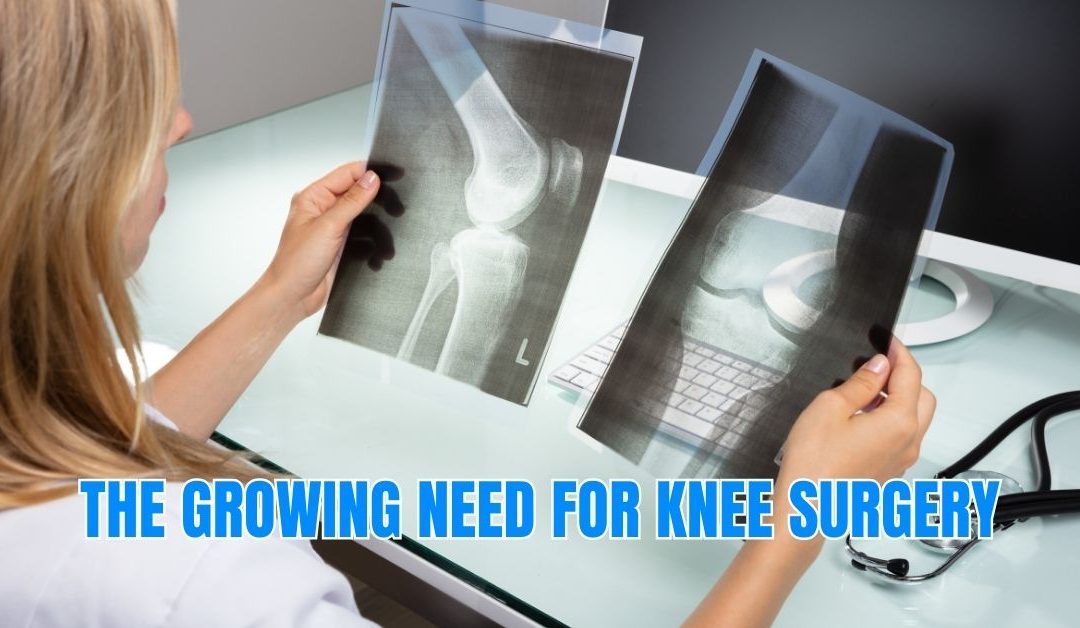 The Growing Need for Knee Surgery