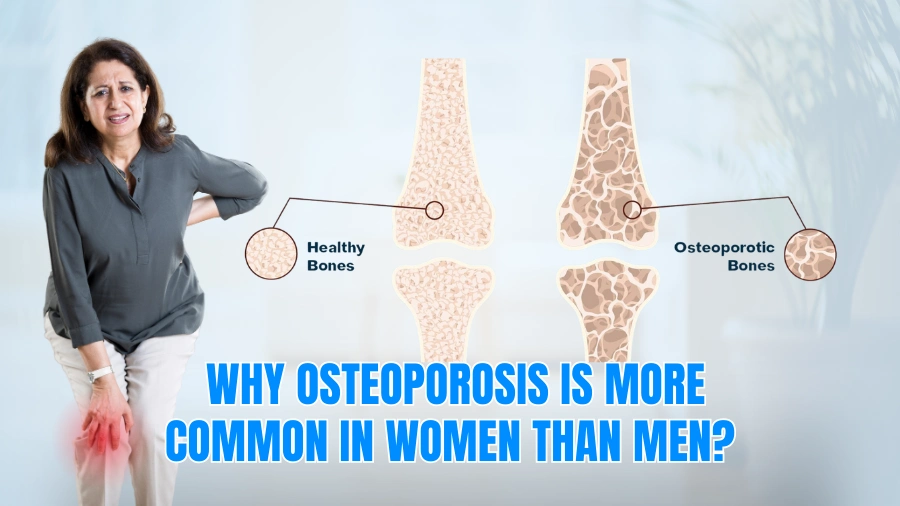 Why Osteoporosis Is More Common in Women than Men?